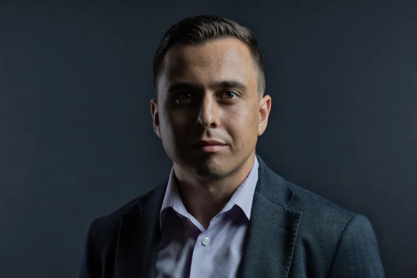 Avant Hollywood Smile — sourire irrégulier